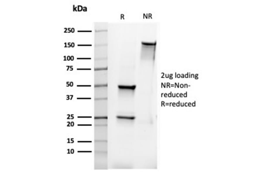 SDS-PAGE - Anti-Bcl-2 Antibody [rBCL2/6418] - BSA and Azide free (A253043) - Antibodies.com