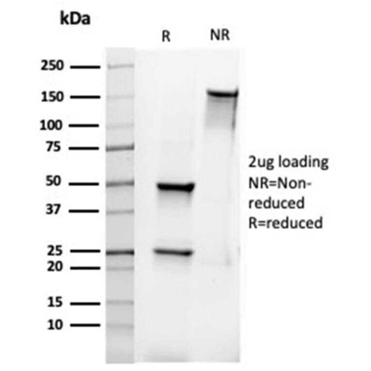 SDS-PAGE - Anti-Bcl-2 Antibody [rBCL2/6418] - BSA and Azide free (A253043) - Antibodies.com