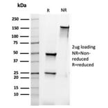 SDS-PAGE - Anti-Bcl-2 Antibody [rBCL2/6418] - BSA and Azide free (A253043) - Antibodies.com