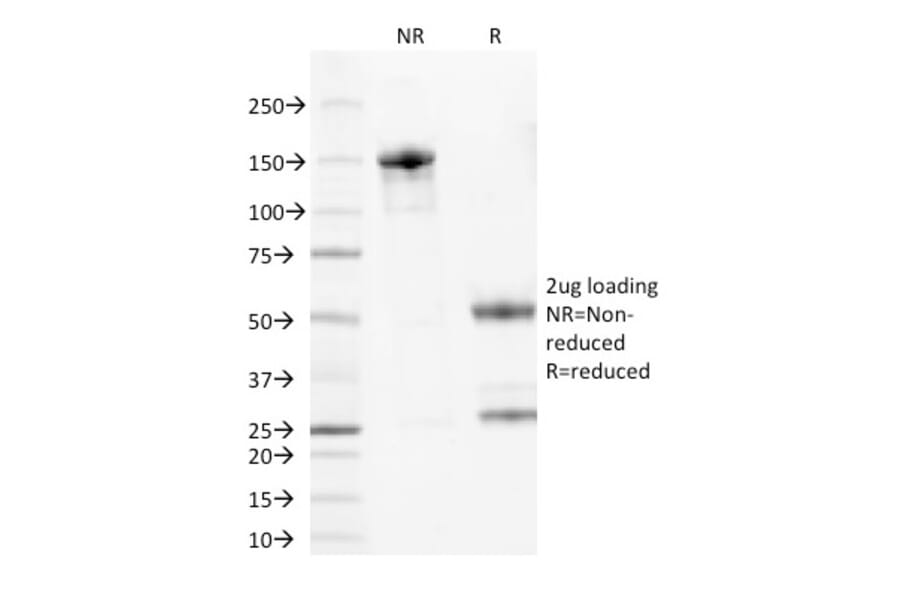 SDS-PAGE - Anti-Bcl-2 Antibody [100/D5] - BSA and Azide free (A253044) - Antibodies.com