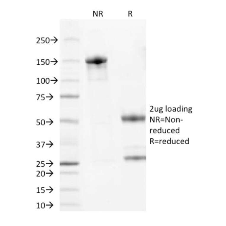 SDS-PAGE - Anti-Bcl-2 Antibody [100/D5] - BSA and Azide free (A253044) - Antibodies.com