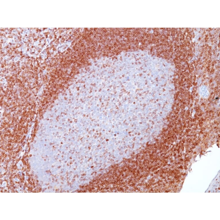 Immunohistochemistry - Anti-Bcl-2 Antibody [SPM117] - BSA and Azide free (A253044) - Antibodies.com