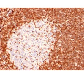 Immunohistochemistry - Anti-Bcl-2 Antibody [8C8] - BSA and Azide free (A253045) - Antibodies.com