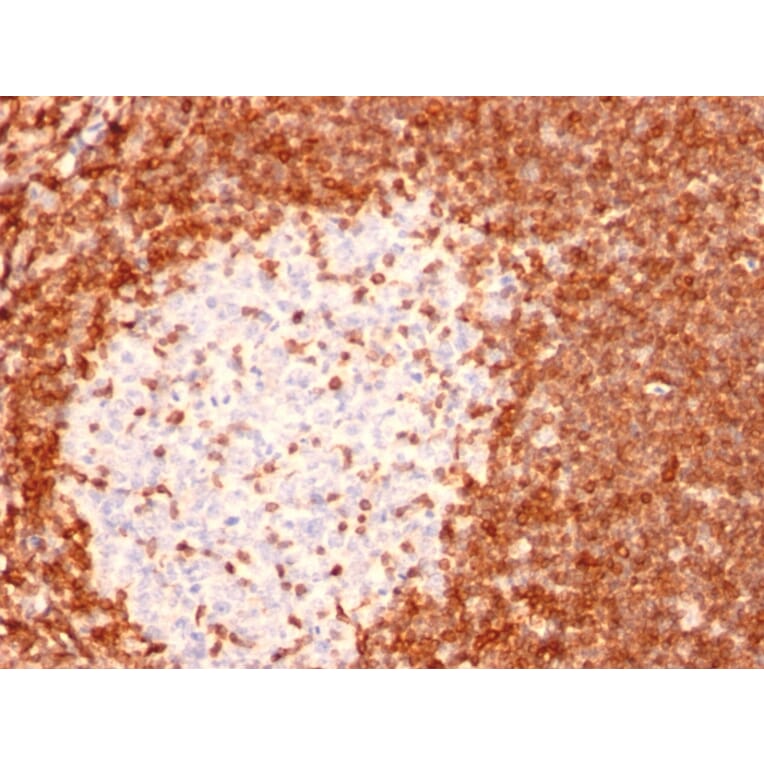 Immunohistochemistry - Anti-Bcl-2 Antibody [8C8] - BSA and Azide free (A253045) - Antibodies.com