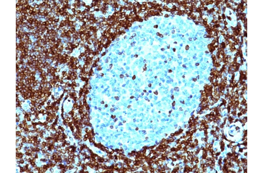 Immunohistochemistry - Anti-Bcl-2 Antibody [124] - BSA and Azide free (A253046) - Antibodies.com