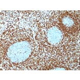 Immunohistochemistry - Anti-Bcl-2 Antibody [124] - BSA and Azide free (A253047) - Antibodies.com