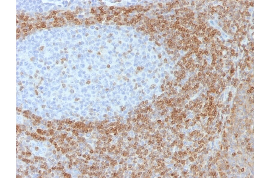 Immunohistochemistry - Anti-Bcl-2 Antibody [SPM530] - BSA and Azide free (A253047) - Antibodies.com