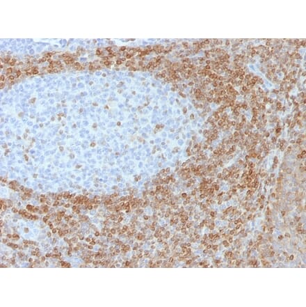 Immunohistochemistry - Anti-Bcl-2 Antibody [SPM530] - BSA and Azide free (A253047) - Antibodies.com