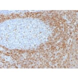 Immunohistochemistry - Anti-Bcl-2 Antibody [SPM530] - BSA and Azide free (A253047) - Antibodies.com