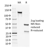 SDS-PAGE - Anti-Bcl-2 Antibody [100/D5+124] - BSA and Azide free (A253049) - Antibodies.com