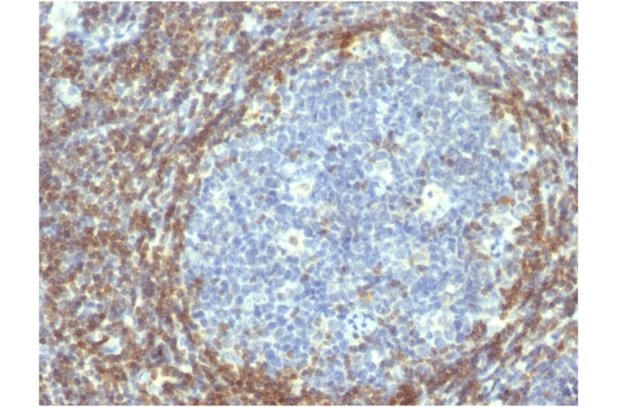 Immunohistochemistry - Anti-Bcl-2 Antibody [BCL2/782] - BSA and Azide free (A253050) - Antibodies.com