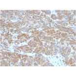 Immunohistochemistry - Anti-Bcl-2 Antibody [BCL2/782] - BSA and Azide free (A253049) - Antibodies.com