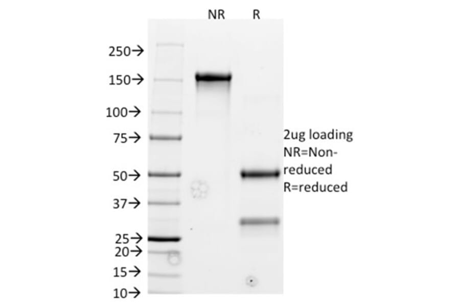 SDS-PAGE - Anti-Bcl-2 Antibody [BCL2/782] - BSA and Azide free (A253050) - Antibodies.com
