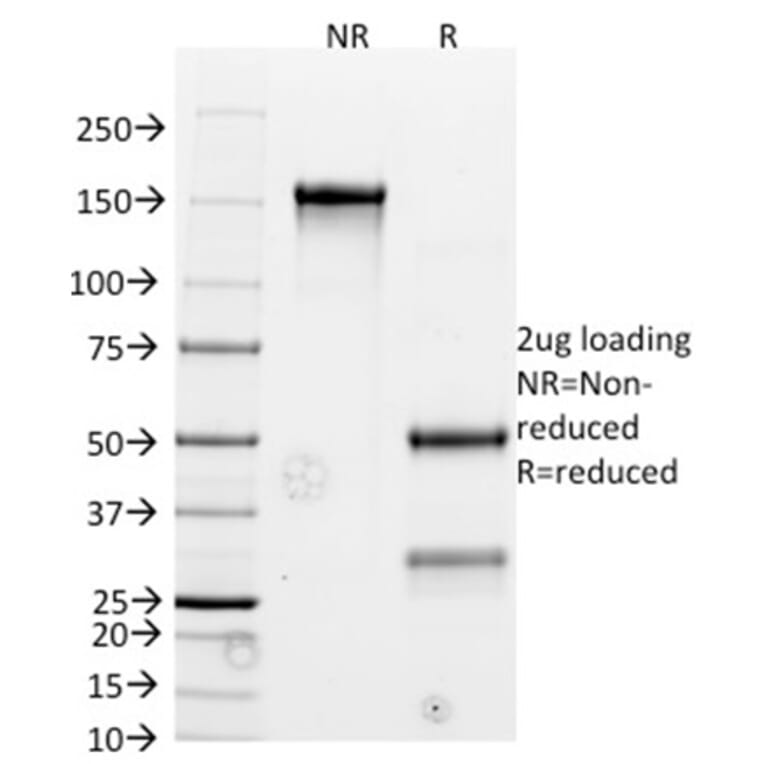 SDS-PAGE - Anti-Bcl-2 Antibody [BCL2/782] - BSA and Azide free (A253050) - Antibodies.com