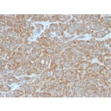 Immunohistochemistry - Anti-Bcl-2 Antibody [BCL2/796] - BSA and Azide free (A253050) - Antibodies.com