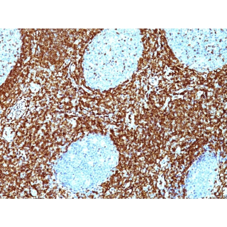 Immunohistochemistry - Anti-Bcl-2 Antibody [BCL2/782 + BCL2/796] - BSA and Azide free (A253052) - Antibodies.com