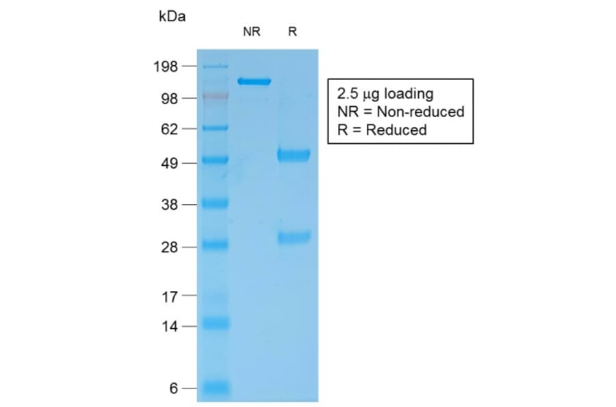 SDS-PAGE - Anti-Bcl-2 Antibody [rBCL2/796] - BSA and Azide free (A253053) - Antibodies.com