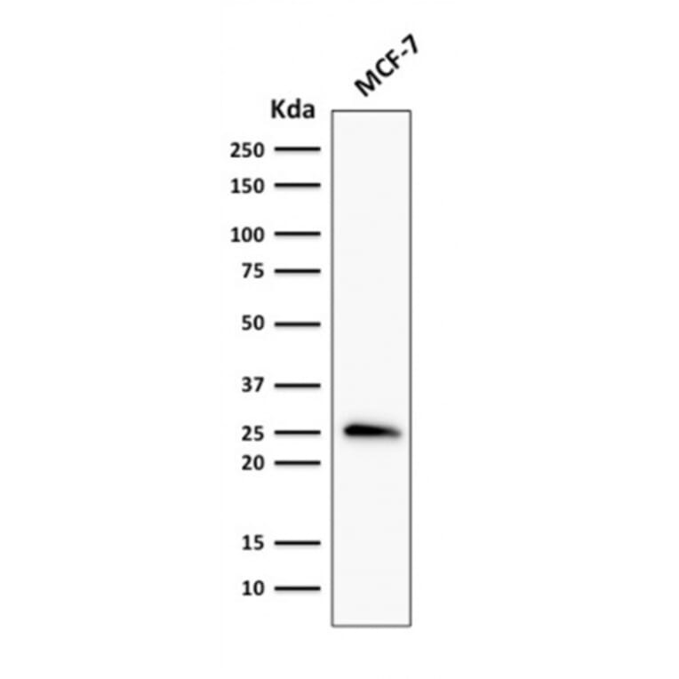 Western Blot - Anti-Bcl-2 Antibody [rBCL2/796] - BSA and Azide free (A253053) - Antibodies.com