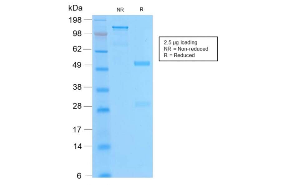 SDS-PAGE - Anti-Bcl-2 Antibody [BCL2/2210R] - BSA and Azide free (A253054) - Antibodies.com