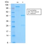 SDS-PAGE - Anti-Bcl-2 Antibody [BCL2/2210R] - BSA and Azide free (A253054) - Antibodies.com