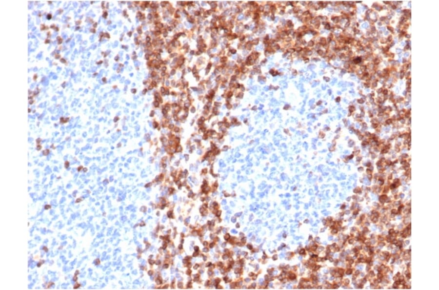Immunohistochemistry - Anti-Bcl-2 Antibody [BCL2/6426R] - BSA and Azide free (A253054) - Antibodies.com