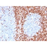 Immunohistochemistry - Anti-Bcl-2 Antibody [BCL2/6426R] - BSA and Azide free (A253054) - Antibodies.com