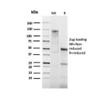 SDS-PAGE - Anti-Bcl-2 Antibody [BCL2/1878R] - BSA and Azide free (A253056) - Antibodies.com