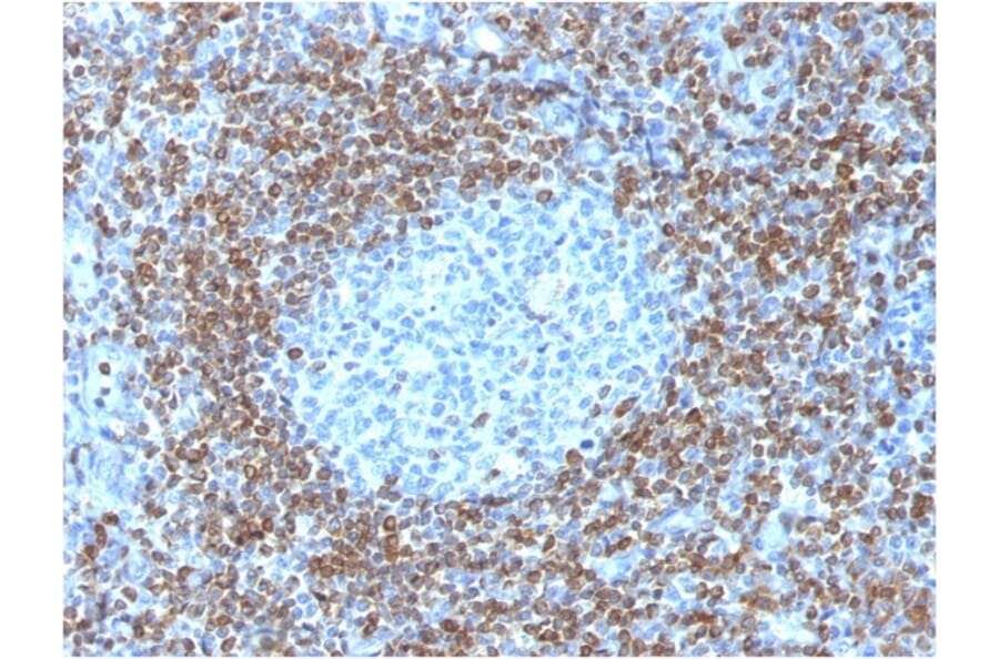 Immunohistochemistry - Anti-Bcl-2 Antibody [BCL2/1878R] - BSA and Azide free (A253056) - Antibodies.com