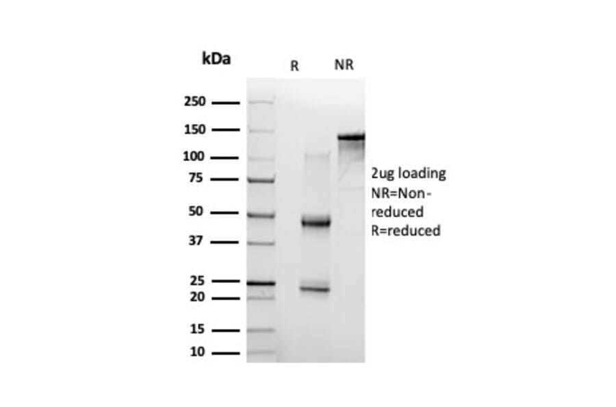 SDS-PAGE - Anti-NF-kB p65 Antibody [PCRP-RELA-1E3] - BSA and Azide free (A253057) - Antibodies.com