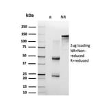 SDS-PAGE - Anti-NF-kB p65 Antibody [PCRP-RELA-1E3] - BSA and Azide free (A253057) - Antibodies.com