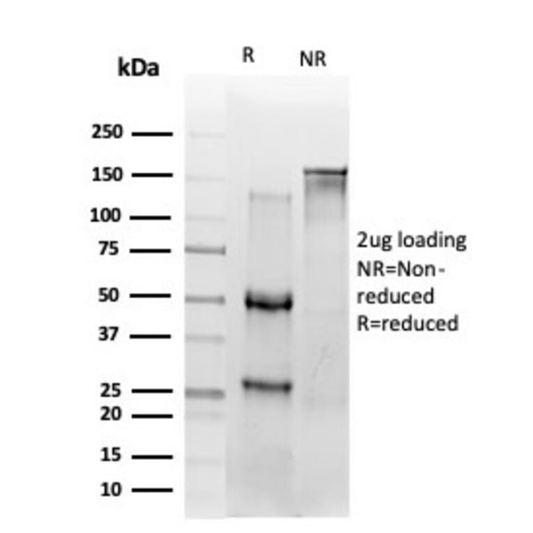 SDS-PAGE - Anti-NF-kB p65 Antibody [PCRP-RELA-2B6] - BSA and Azide free (A253058) - Antibodies.com