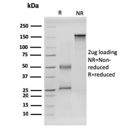 SDS-PAGE - Anti-RET Antibody [RET/2599] - BSA and Azide free (A253059) - Antibodies.com