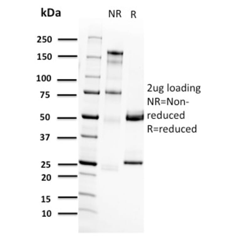 SDS-PAGE - Anti-RET Antibody [RET/2662] - BSA and Azide free (A253060) - Antibodies.com