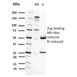 SDS-PAGE - Anti-RET Antibody [RET/2662] - BSA and Azide free (A253060) - Antibodies.com