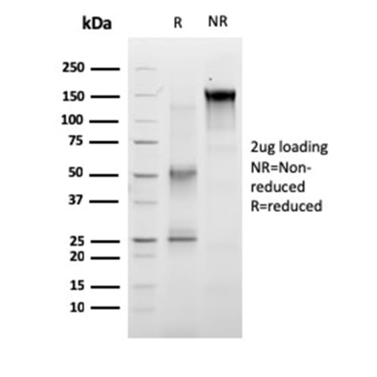 SDS-PAGE - Anti-RET Antibody [RET/2663] - BSA and Azide free (A253061) - Antibodies.com