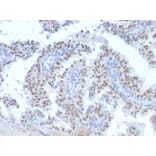 Immunohistochemistry - Anti-RET Antibody [RET/2663] - BSA and Azide free (A253061) - Antibodies.com