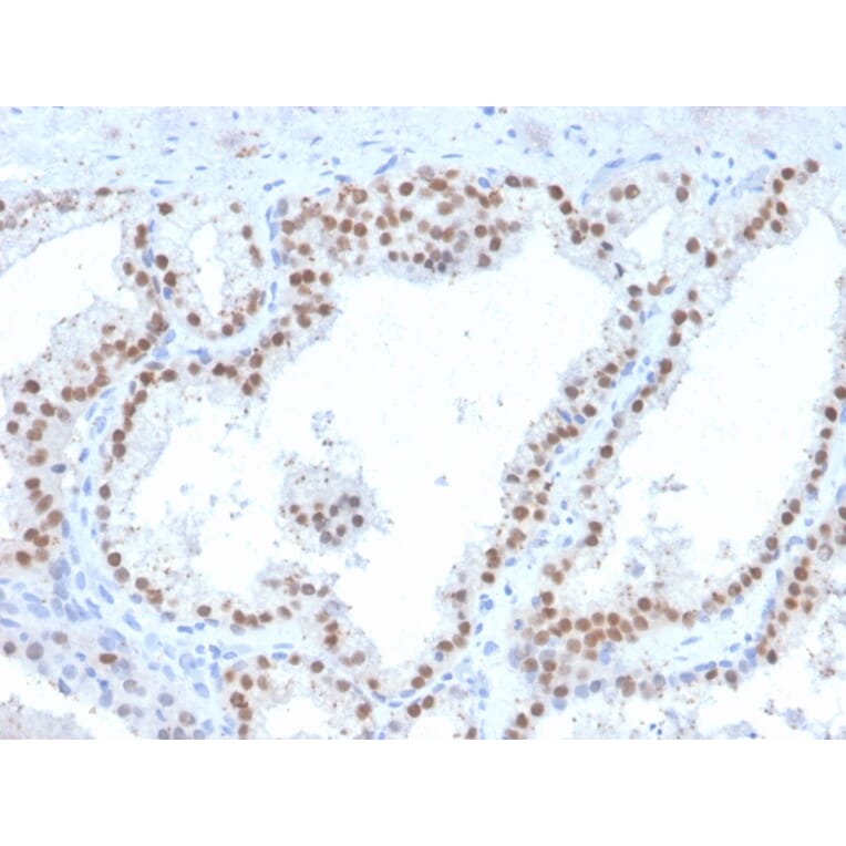 Immunohistochemistry - Anti-RET Antibody [RET/2663] - BSA and Azide free (A253061) - Antibodies.com