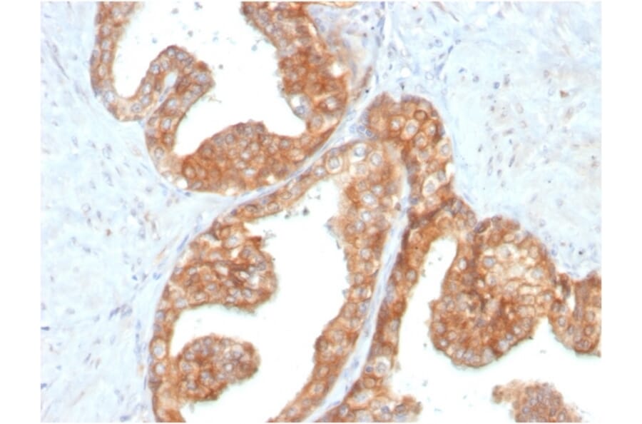 Immunohistochemistry - Anti-RET Antibody [RET/2795] - BSA and Azide free (A253062) - Antibodies.com