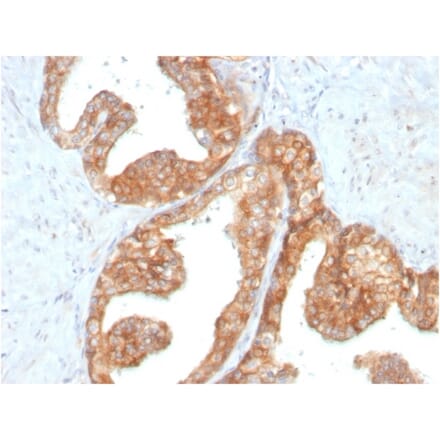 Immunohistochemistry - Anti-RET Antibody [RET/2795] - BSA and Azide free (A253062) - Antibodies.com