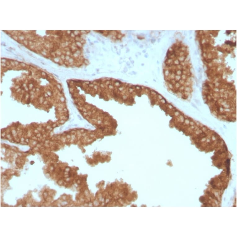 Immunohistochemistry - Anti-RET Antibody [RET/2795] - BSA and Azide free (A253062) - Antibodies.com