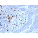 Immunohistochemistry - Anti-RET Antibody [RET/2795] - BSA and Azide free (A253062) - Antibodies.com