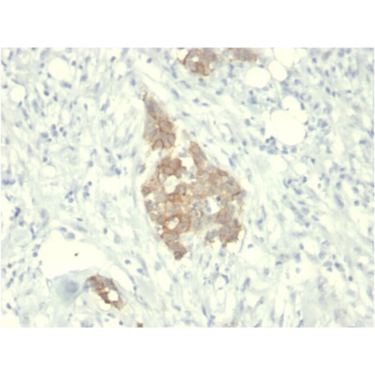 Immunohistochemistry - Anti-RET Antibody [RET/2795] - BSA and Azide free (A253062) - Antibodies.com