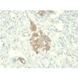 Immunohistochemistry - Anti-RET Antibody [RET/2795] - BSA and Azide free (A253062) - Antibodies.com