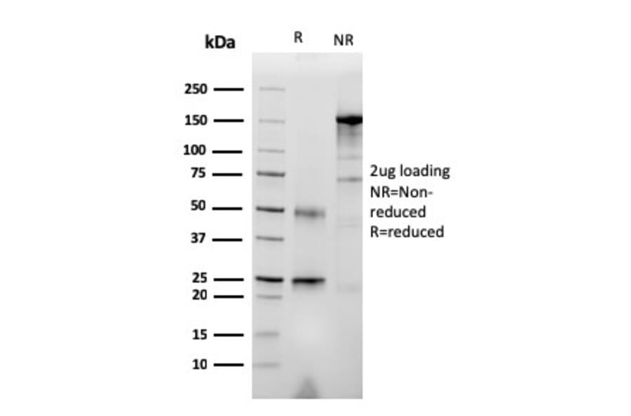 SDS-PAGE - Anti-RET Antibody [RET/2976] - BSA and Azide free (A253063) - Antibodies.com