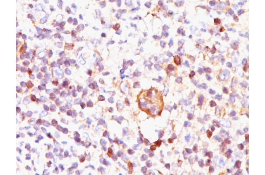 Immunohistochemistry - Anti-Bcl-X Antibody [BX006] - BSA and Azide free (A249885) - Antibodies.com