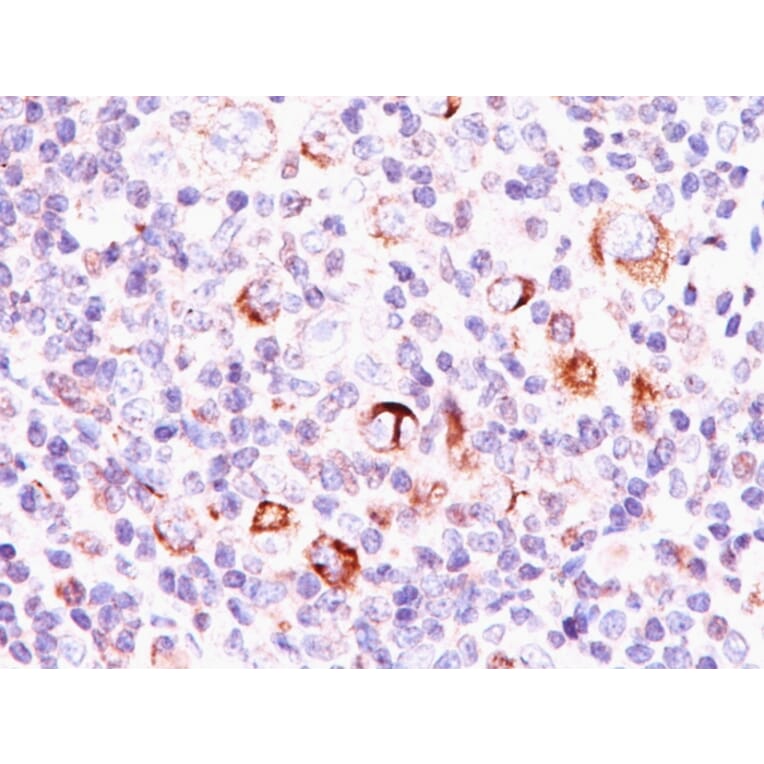 Immunohistochemistry - Anti-Bcl-X Antibody [SPM337] - BSA and Azide free (A253067) - Antibodies.com