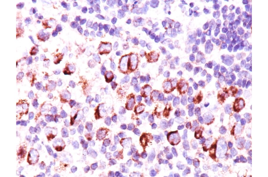 Immunohistochemistry - Anti-Bcl-X Antibody [BX006 + 2H12] - BSA and Azide free (A253068) - Antibodies.com