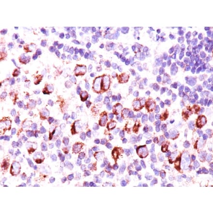 Immunohistochemistry - Anti-Bcl-X Antibody [BX006 + 2H12] - BSA and Azide free (A253068) - Antibodies.com