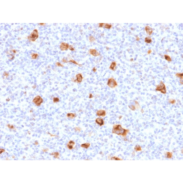 Immunohistochemistry - Anti-Bcl-X Antibody [SPM519] - BSA and Azide free (A249891) - Antibodies.com