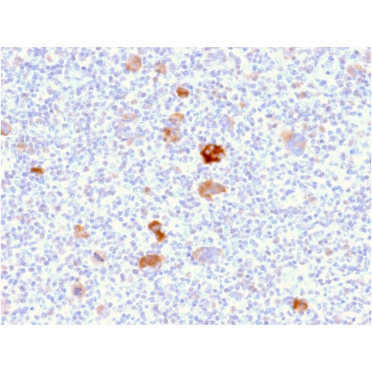 Immunohistochemistry - Anti-Bcl-X Antibody [BCL2L1/2406] - BSA and Azide free (A253072) - Antibodies.com